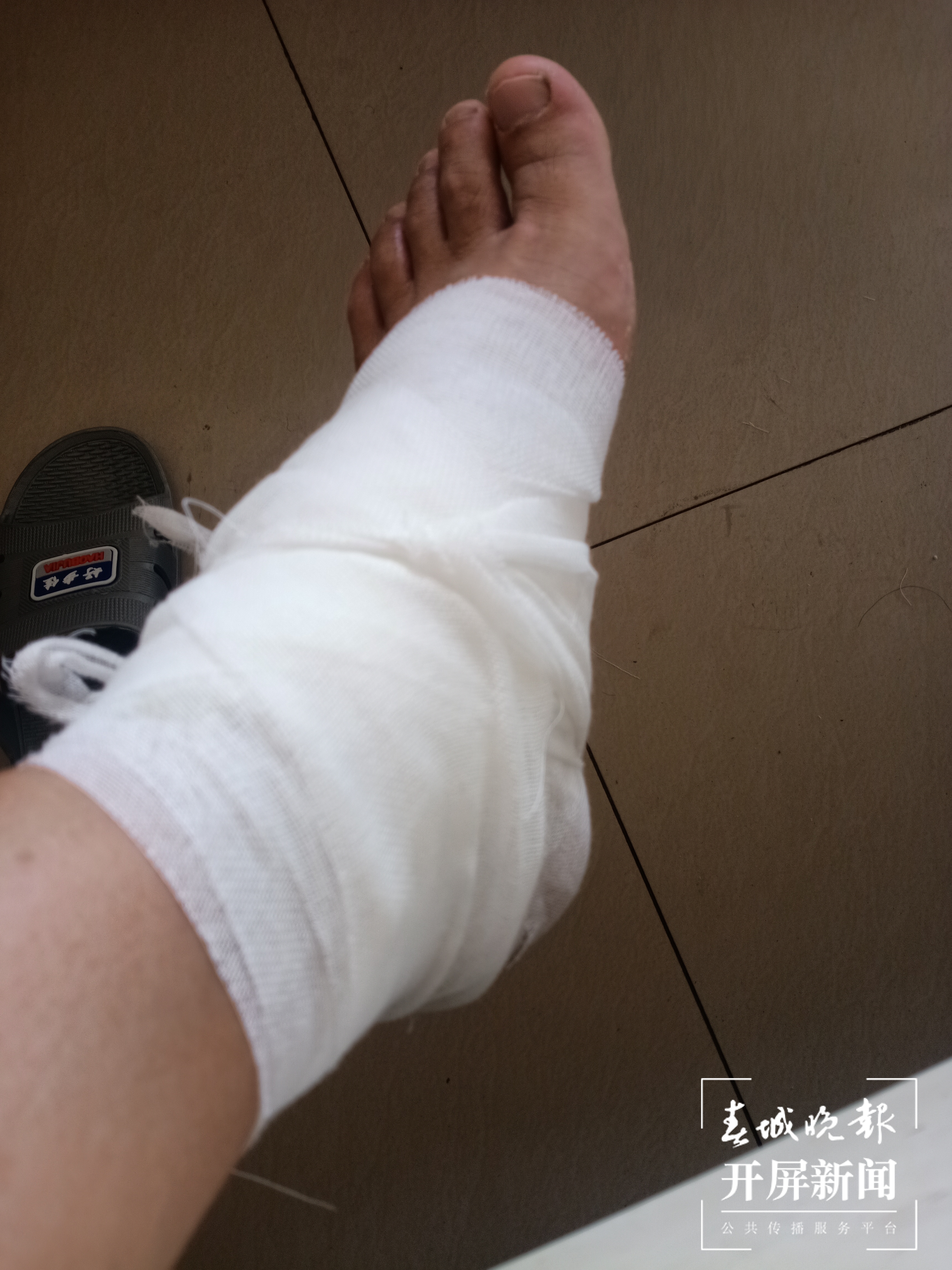 大理一名辅警被落石砸伤脚踝！他咬牙坚守疏导保通一线（春城晚报-开屏新闻记者 秦蒙琳 程权 龙宇丹 马雯 通讯员 黄国庆 张汉 摄）