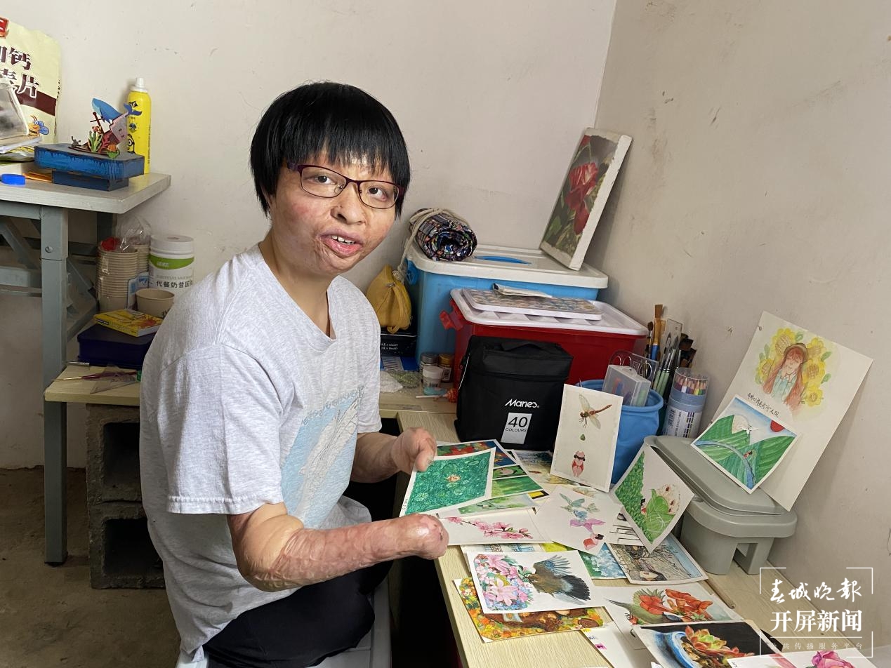 艾维眼科医院助梦青春 ，助力“浴火女孩”唐敏追逐梦想