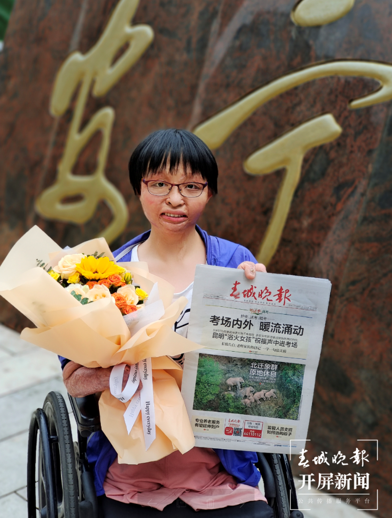 昆明“浴火女孩”唐敏(春城晚报-开屏新闻记者 费丹艺 杨露 江洋 摄）