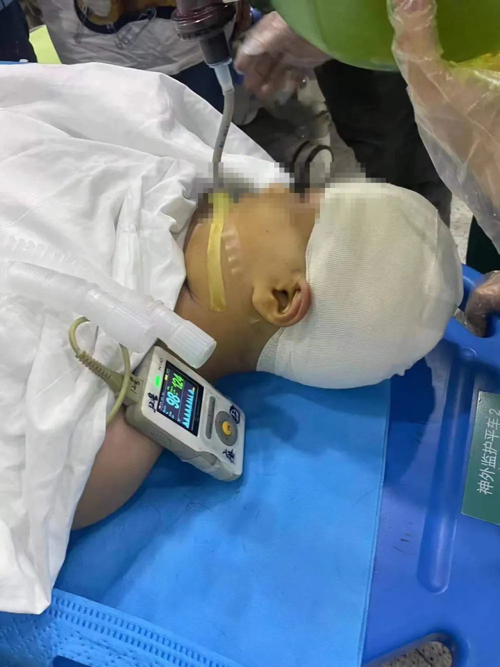 “老师故意打我”！被老师打破头骨女孩讲述事发细节→