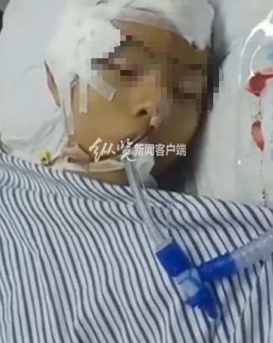 广东一中学生疑被打成植物人，官方通报.png